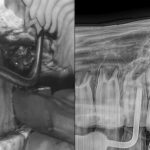 Stütz- und Führungsset für dentale Hebel – Bild 6