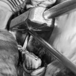 Stütz- und Führungsset für dentale Hebel – Bild 7